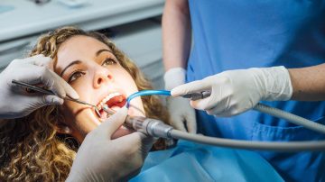 Professional Teeth Cleaning Explained