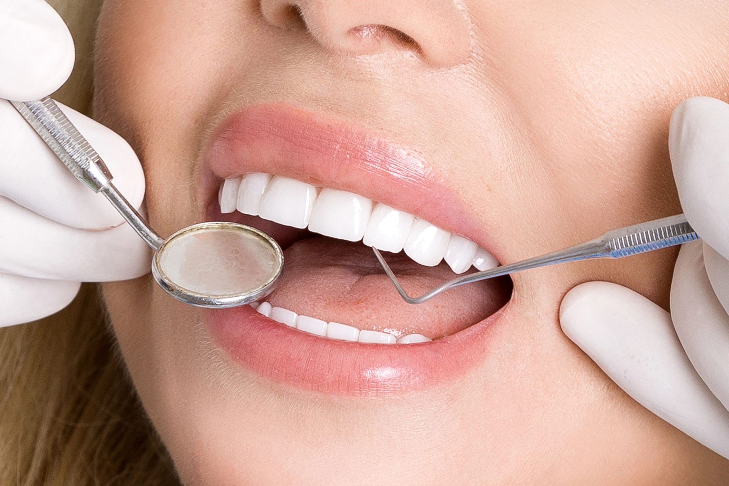 Best Teeth Whitening Toothpaste: Top Picks for a Brighter Smile