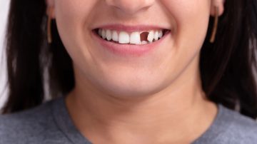 What To Do for a Knocked-Out Tooth Emergency