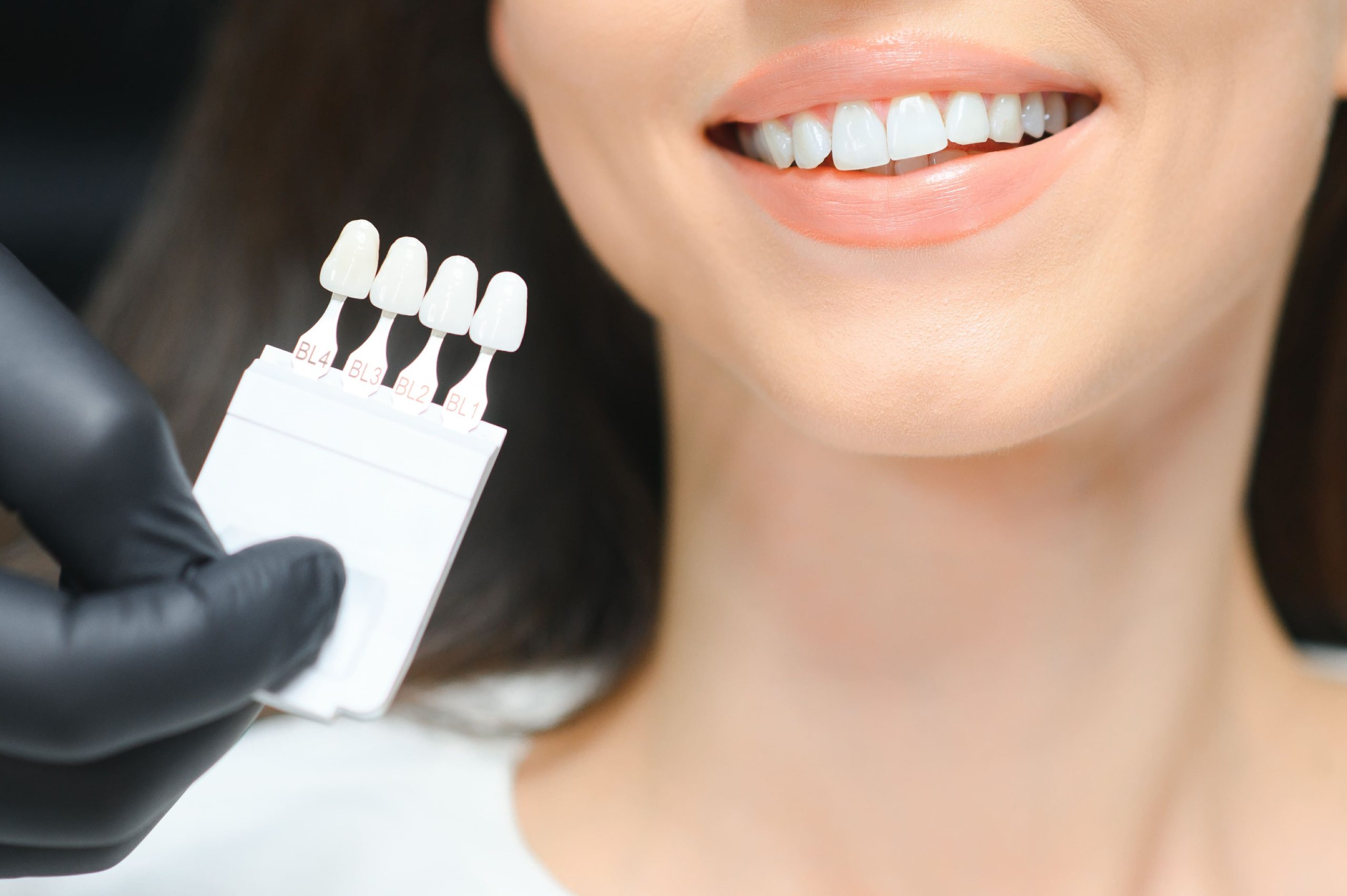 Natural Teeth Whitening Methods: Safe and Effective Ways to Brighten Your Smile
