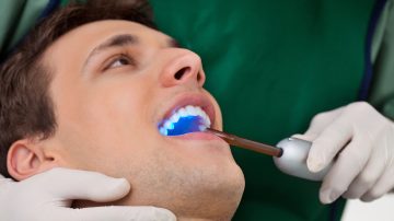 Home Remedies for Teeth Whitening: Simple and Affordable Solutions