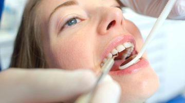 How to Handle a Lost Filling or Crown Fast