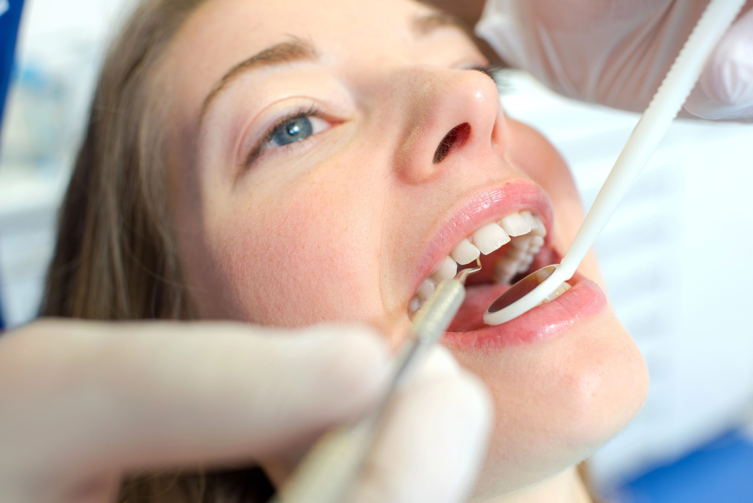 Explore How to Handle a Lost Filling or Crown Fast at Norwood Dental Cosmetics in Norwood, MA