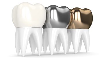 Dental Crown vs Bridge: Choosing the Right Option for Missing or Damaged Teeth