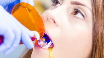 Cosmetic Tooth Bonding Dentist Near Me: Choosing the Right Specialist