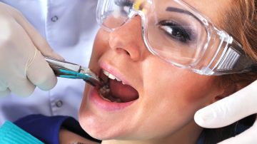 Benefits of Tooth Extraction: Why It May Be the Best Option
