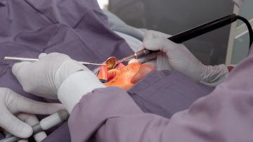 Scaling and Root Planing Near Me: Choosing the Right Dentist