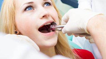 Aftercare Tips for Tooth Extraction: Ensuring a Smooth Recovery