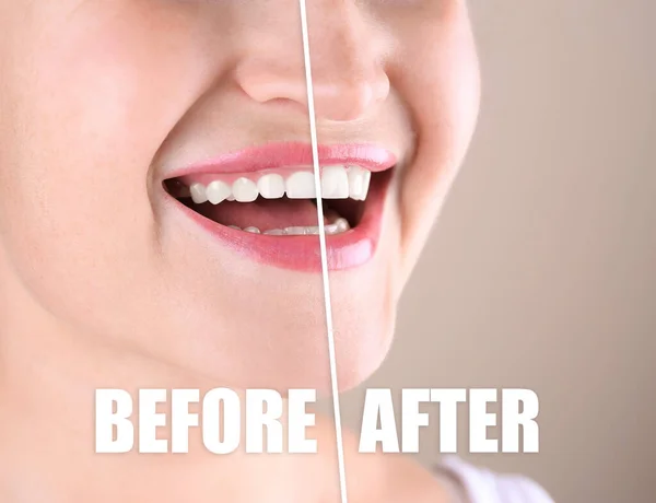 Unveiling the Truth: Top 5 Myths About Gum Contouring Debunked