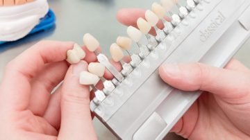 Unveiling the Journey to Perfect Smiles with Dental Veneers