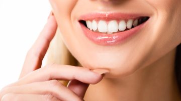 The Cost of Dental Veneers Norwood and Whether It’s Worth the Investment