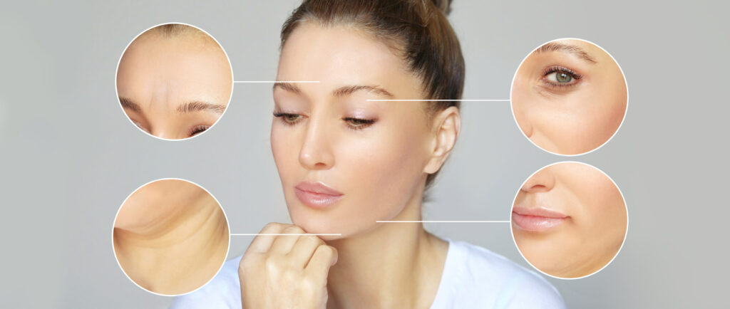 BOTOX®